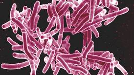 Tuberculosis envía al hospital a unos 120 costarricenses cada año