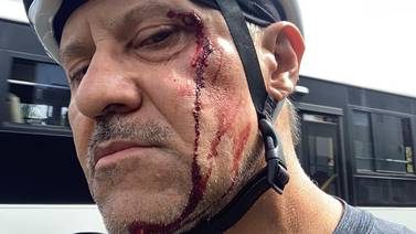 Hombres fracturaron cara a jefe de Operaciones de Irex mientras hacía ciclismo en Tres Ríos