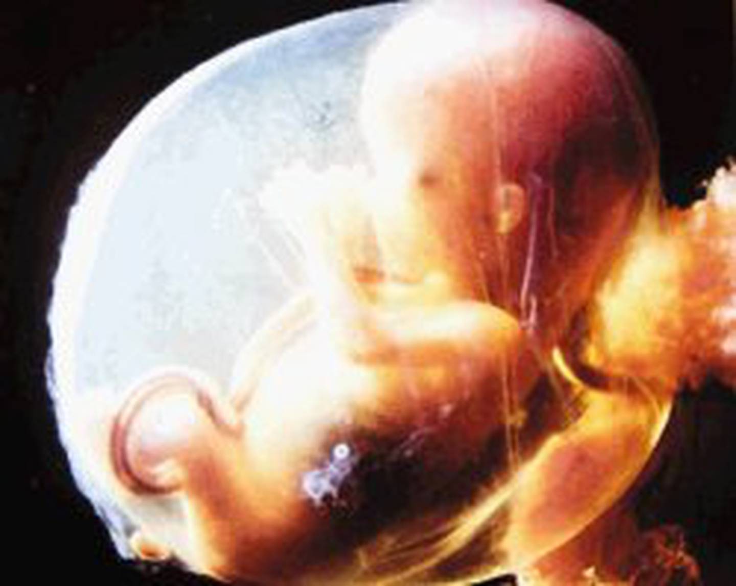 Шестнадцати недель. Плод ребенка. Малыш в утробе матери. Эмбрион на 15 неделе беременности.