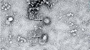 Así se ve el nuevo coronavirus en un microscopio electrónico