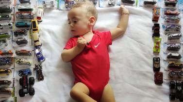 Enfermedades raras: Bebé enfrenta padecimiento visto solo dos veces en Costa Rica