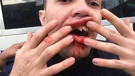 Taxista que le quebró tres dientes a policía irá dos meses a prisión