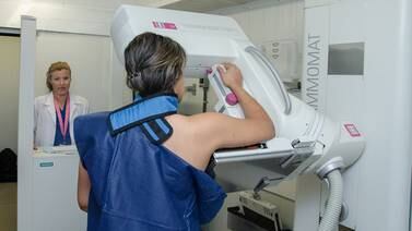 Unidad Móvil Lazos dona 570 mamografías