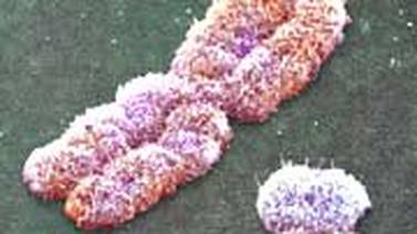Hombres mueren más por nuevo coronavirus que mujeres... cromosomas, anticuerpos y hasta hábitos son posibles motivos