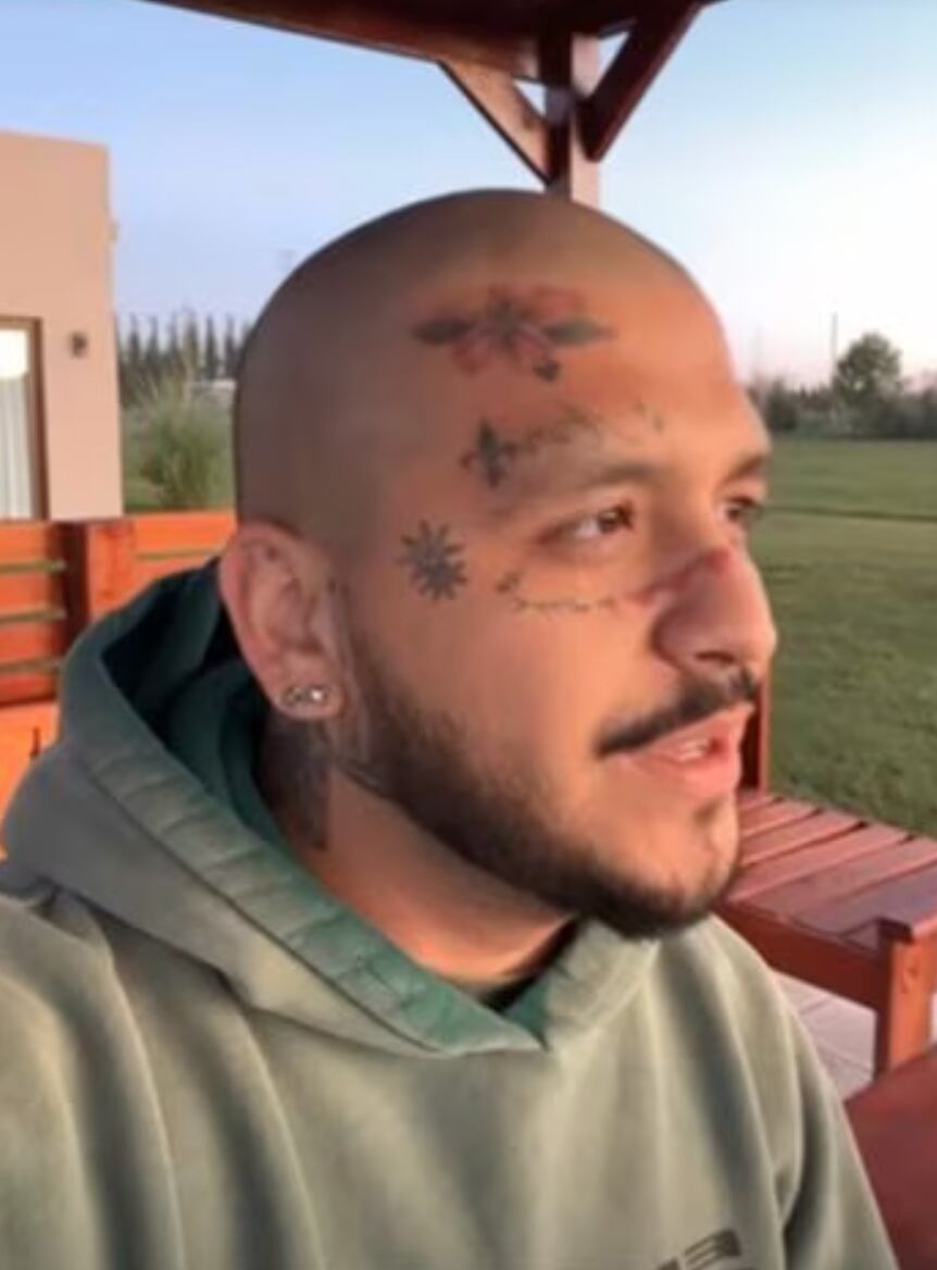 Christian Nodal tiene aproximadamente 10 tatuajes en su rostro, por lo que tendrá que someterse a varias sesiones para lograr removerlos.