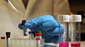 Salud investiga caso de influenza A por sospecha de subtipo no conocido en humanos