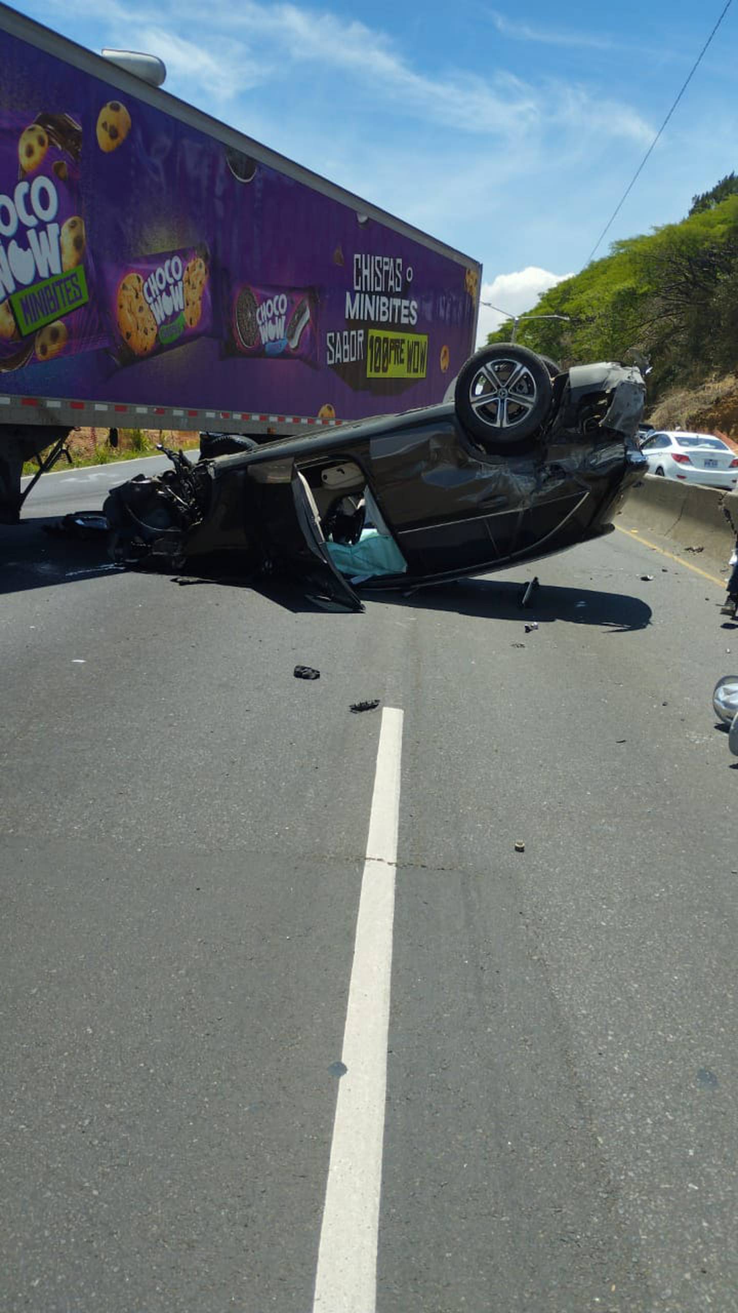 Accidente ocurrió poco antes de las 11 a. m. en la autopista General Cañas, muy cerca del Real Cariari.