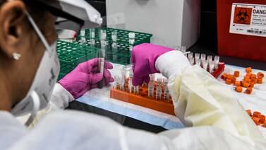 Moderna comienza ensayos en humanos de vacuna contra el VIH