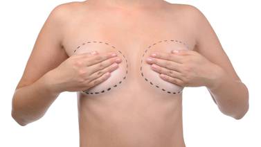 Alerta sanitaria por relación entre implantes mamarios y un tipo de cáncer del sistema inmune 