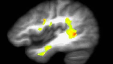 Científicos descifran cómo escucha el cerebro
