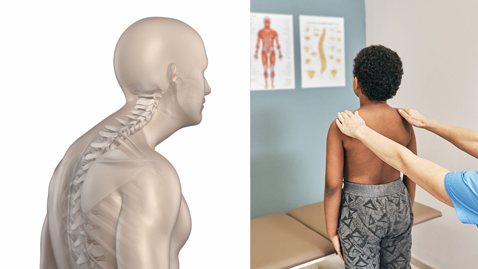 La cifosis se refiere a la curvatura natural que presenta la columna vertebral en su parte superior, conocida como la región torácica.