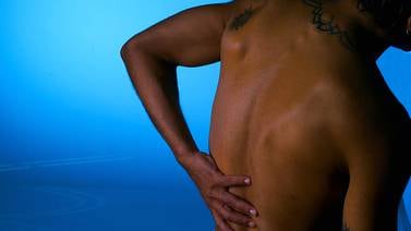 Dolores de espalda causaron 76.500 incapacidades en 2014
