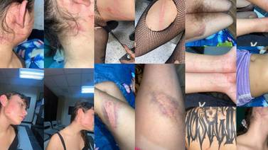 ‘Me golpearon, arrancaron el pelo y tocaron’: Joven denuncia agresión policial en Alajuela