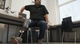 Austríaco es el primero en utilizar una prótesis 'sensible' 