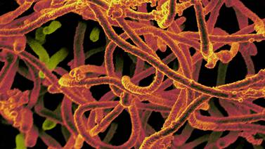 Vacuna en aerosol contra el ébola funciona en monos, sigue estudio en humanos 