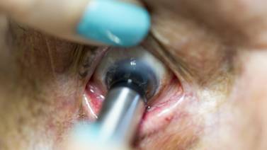 Hospital revisa ojos a 400 porteños diabéticos para prevenir daño en retina