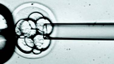 Alto costo frena estudio con células madre embrionarias