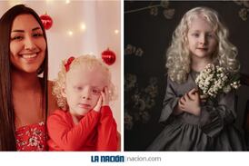 Rheychel y Kaily: madre e hija ticas educan sobre albinismo en TikTok