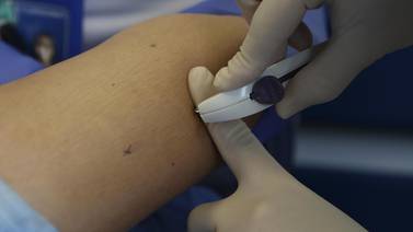 49.000 adolescentes evitan embarazos con implante que se coloca bajo la piel