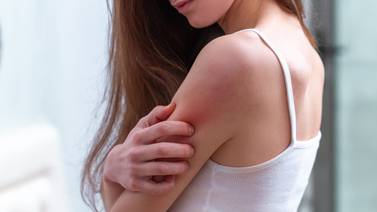 Dermatitis atópica, una enfermedad de la piel agravada por la pandemia y que afecta la autoestima