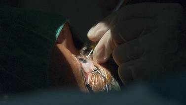 Clínica Oftalmológica saca a 1.000 enfermos de listas de espera de cirugía de cataratas