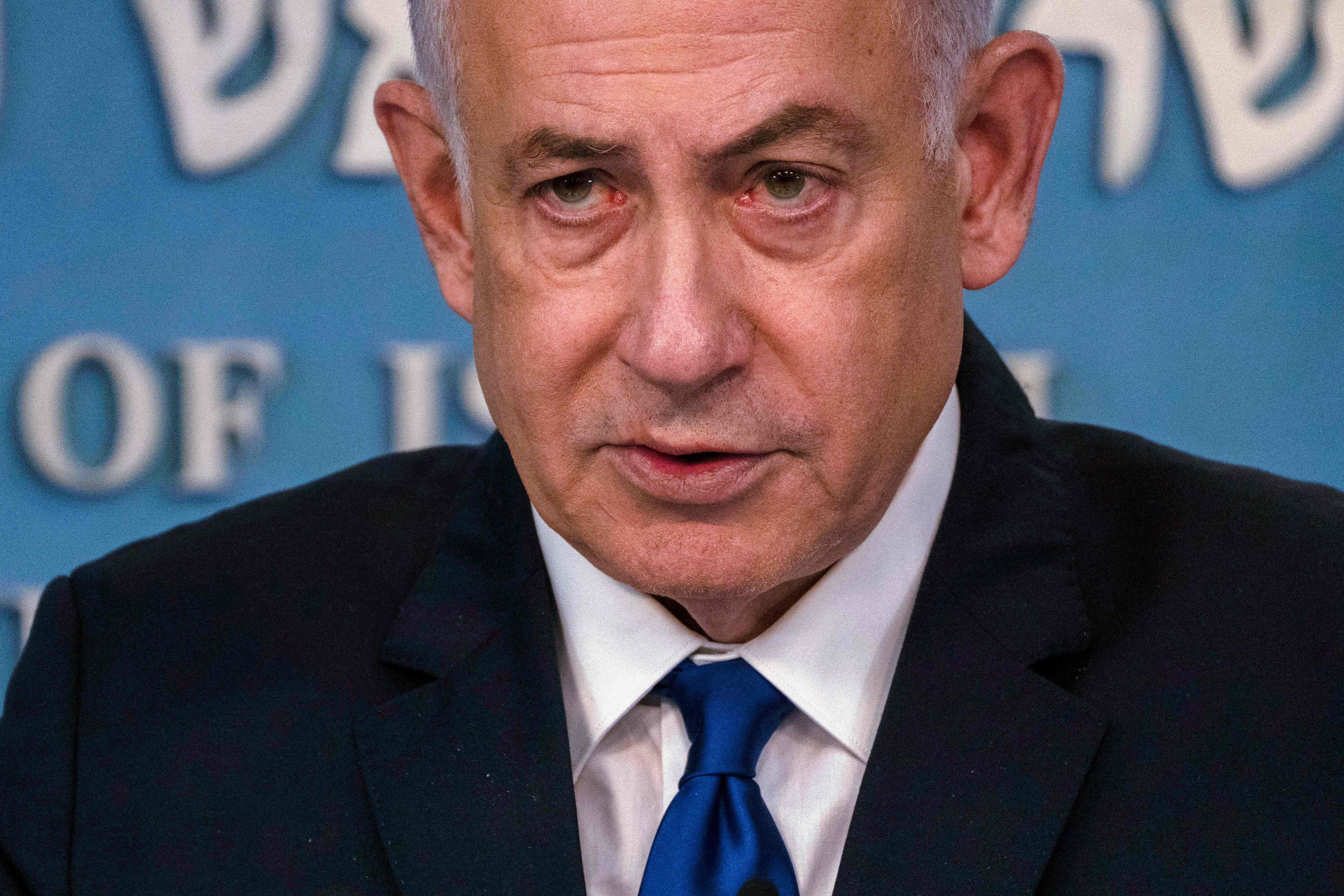 Netanyahu, de 74 años, se sometió a una operación de hernia y su estado físico es motivo de preocupación, ya que también tiene un marcapasos implantado desde hace seis meses.
