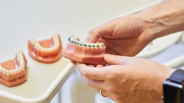 ¿Cuál es el mejor procedimiento de ortodoncia?