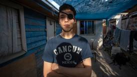 Lesiones oculares y ceguera, las huellas de la protesta social en Chile