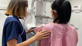 150 mujeres en condición vulnerable recibieron mamografías gratuitas