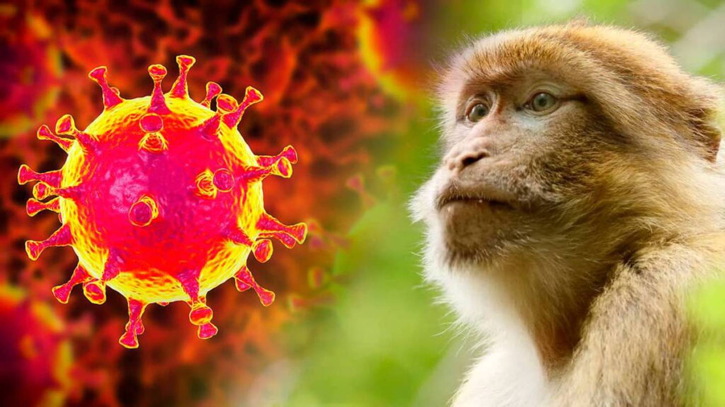 Argentina confirma caso de viruela del mono, primero en Latinoamérica | La  Nación