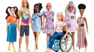Barbie inclusiva: conozca a las muñecas con vitiligo, con prótesis y sin cabello