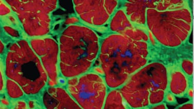 Células madre ayudaron a crear tejido similar a músculo cardíaco
