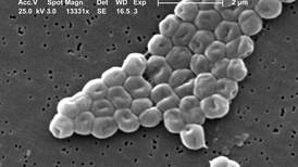 Microbio hallado en Limón da armas contra superbacteria