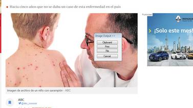 Noticia de franceses con sarampión en  Costa Rica se comentó en su país de origen, España y Reino Unido