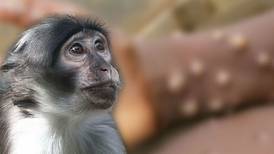 Francia confirma 33 casos de viruela del mono
