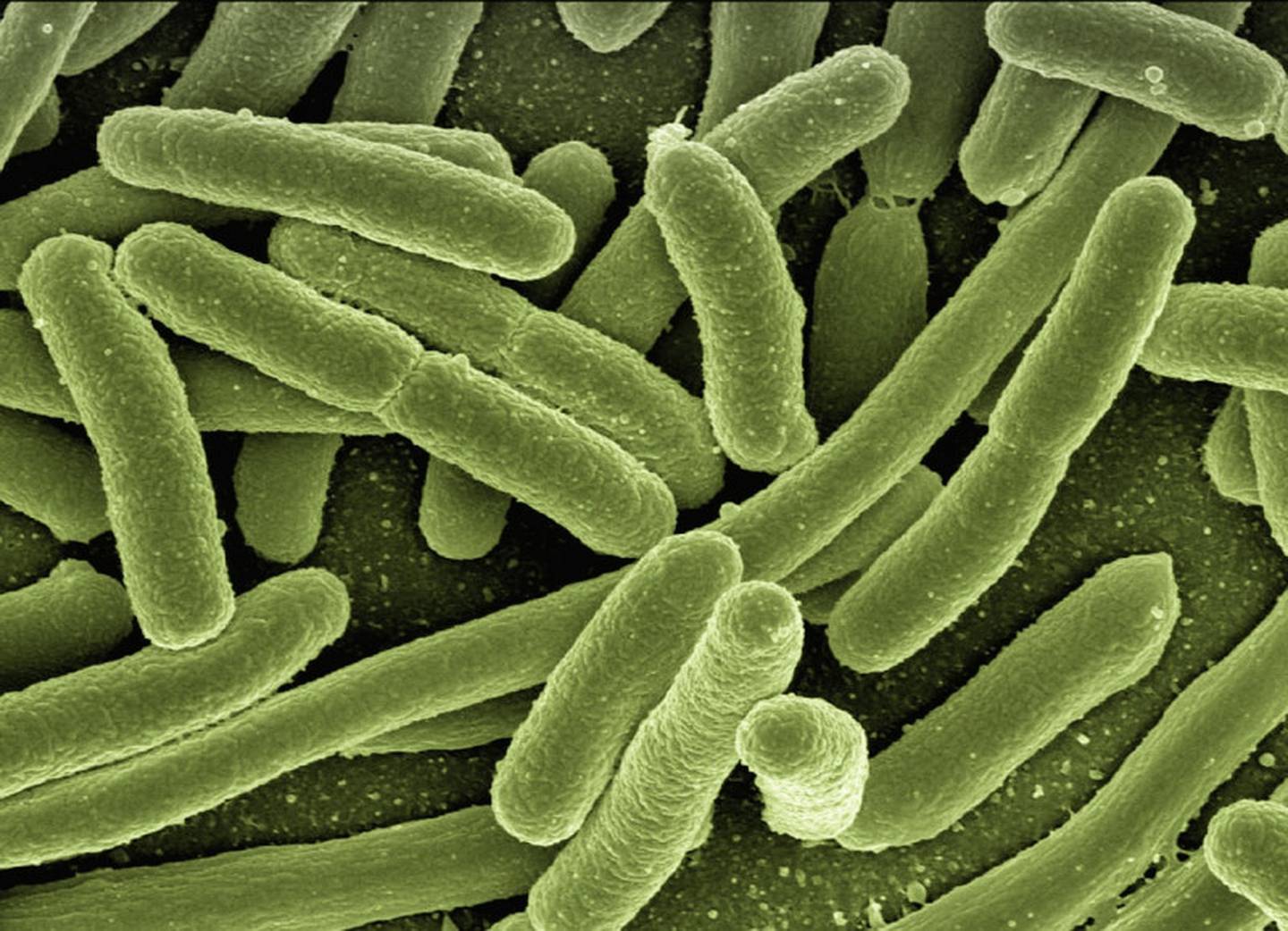 Brote por una bacteria infecciosa causa temor en Japón