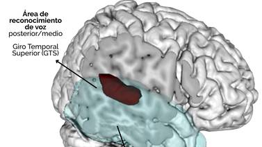 Científicos hallan zona del cerebro encargada de reconocer voces