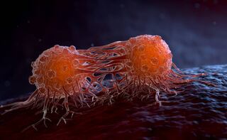 Esta ilustración muestra la forma en la que las células de cáncer se desplazan a otras áreas del cuerpo.

Imagen: Shutterstock