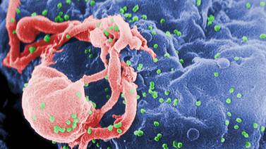 Terapia genética alienta esperanzas en la lucha contra VIH
