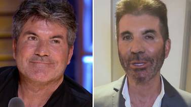 Simon Cowell, juez de ‘American Idol’, criticado por cambios en su rostro