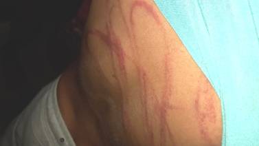 PANI asume protección de cinco hijos de mujer señalada por brutal agresión a uno de ellos en Guápiles