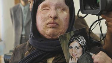 Mujer cegada con ácido libra de castigo a agresor