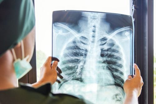 Radiología es una de las especialidades médicas con mayor necesidad en este momento.