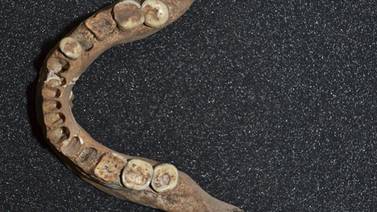  Caries de 15.000 años arrojan luz sobre evolución