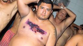 Pandilleros queman su piel para desaparecer tatuajes y evitar ser detenidos en El Salvador