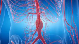  Aneurisma de aorta: riesgos y señales que no pueden ignorarse