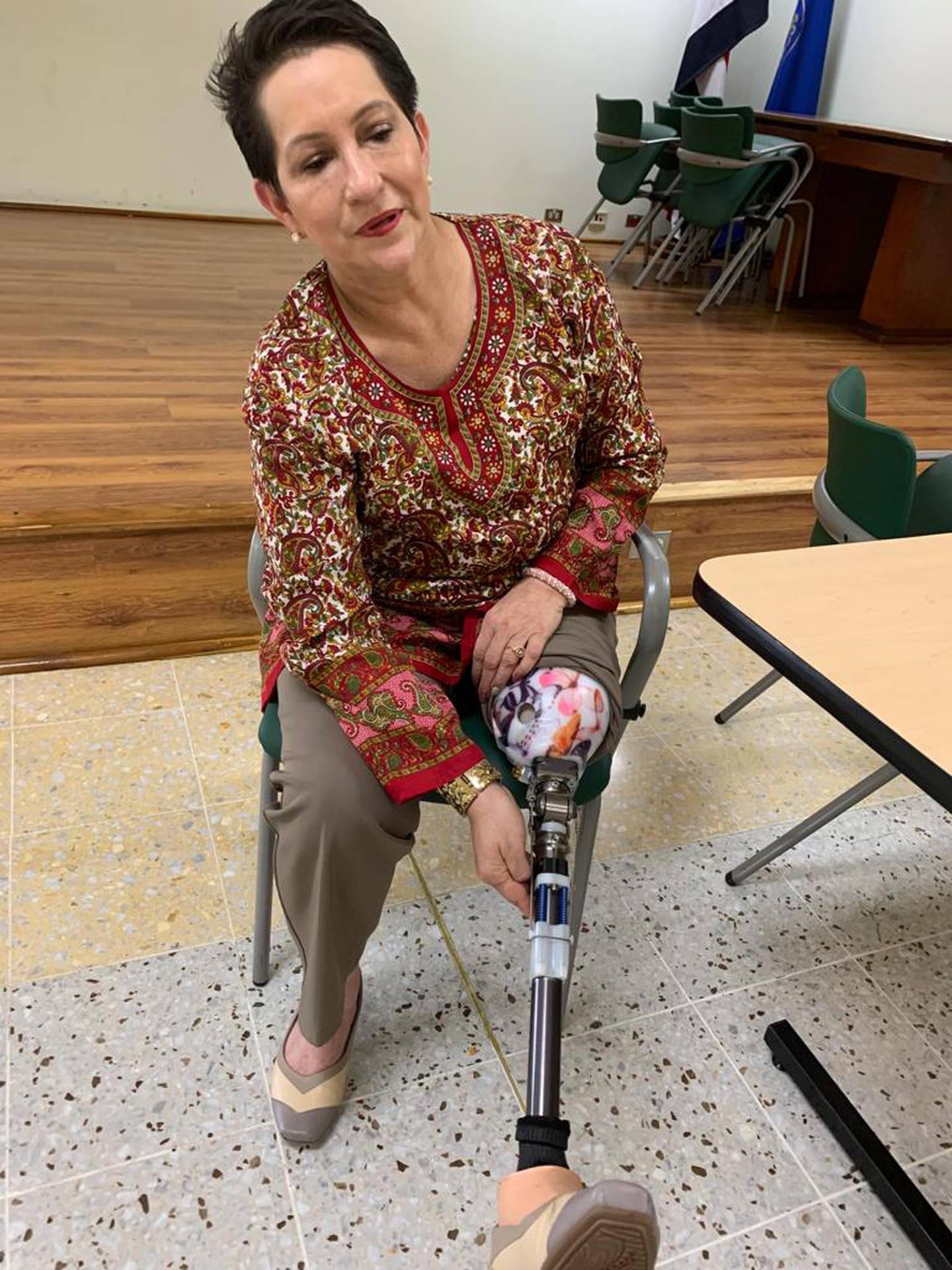 Ana Josefina Güell cuenta cómo enfrentó el cáncer que la dejó sin una pierna, pero le dio un gran impulso para vivir. Foto: María Isabel Solís