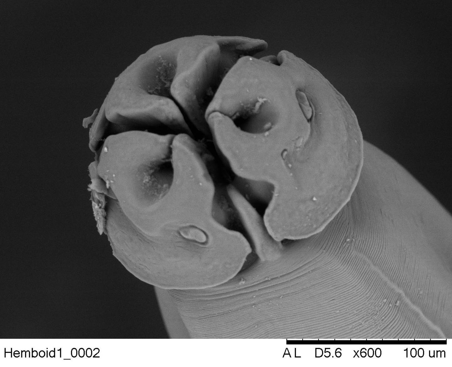 Así se ve el nemátodo 'Lagochilascaris minor' con el microscopio electrónico del Tec.

Fotografía cortesía de la UCR