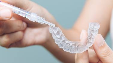 Farmacias no podrán vender blanqueamientos dentales como productos cosméticos, según Colegio de Cirujanos Dentistas 