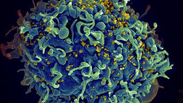 Avance de VIH depende de genéticas del virus y del paciente